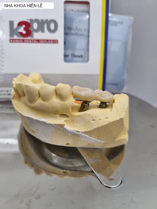 Yến Sào Bạc Liêu - Gợi ý 2 Nha Khoa tốt nhất khu vực Huyện Giá Rai